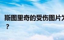 斯图里奇的受伤图片为什么斯图里奇总是受伤？