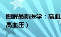 图解最新医学：高血压（关于图解最新医学：高血压）