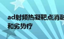 ad射频热凝靶点消融术治颈椎病有什么优热和劣势疗