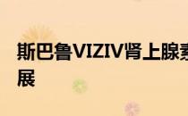 斯巴鲁VIZIV肾上腺素概念首次亮相日内瓦车展