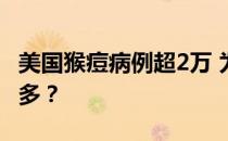 美国猴痘病例超2万 为什么美国猴痘病例那么多？