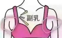 副乳切除手术后注意事项有哪些（手术后前三天注意皮下出血）