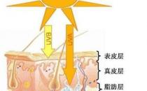 黑色素沉淀怎么去除（可以通过外用脱色剂和激光）