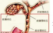 胆结石患者吃什么好？（青菜、胡萝卜）